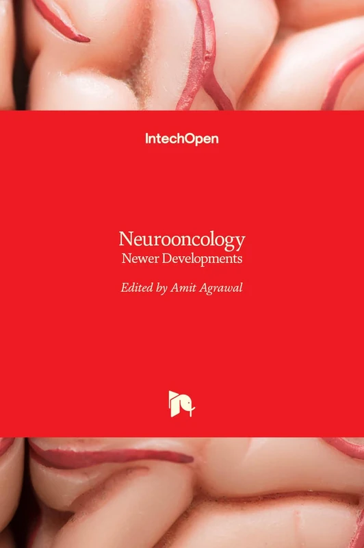 Neurooncology - Newer Developments - Image 1