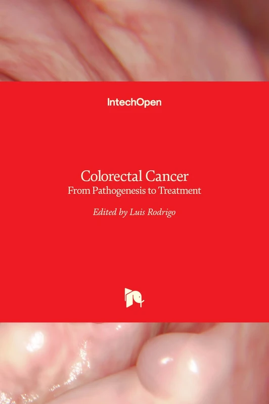 Colorectal Cancer - From Pathogenesis to Treatment