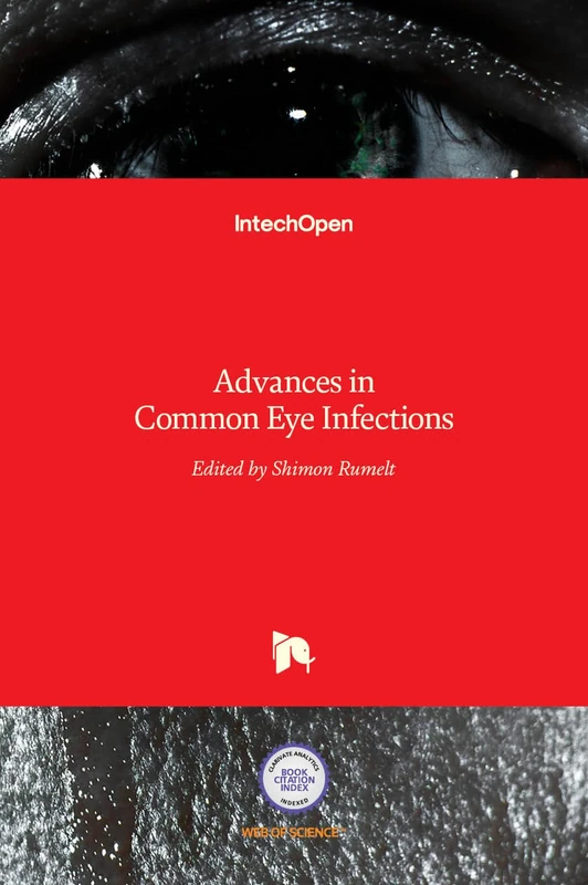 Advances in Common Eye Infections - Image 1