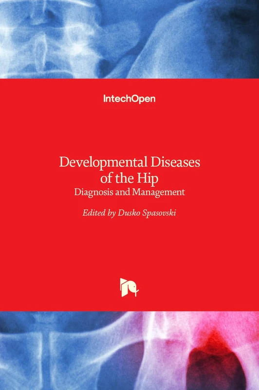 Developmental Diseases of the Hip - Diagnosis and Management