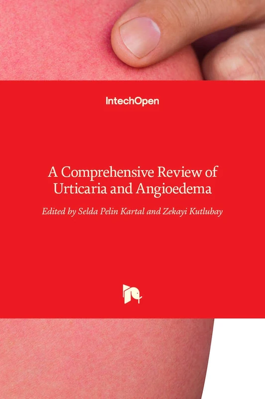 A Comprehensive Review of Urticaria and Angioedema - Image 1