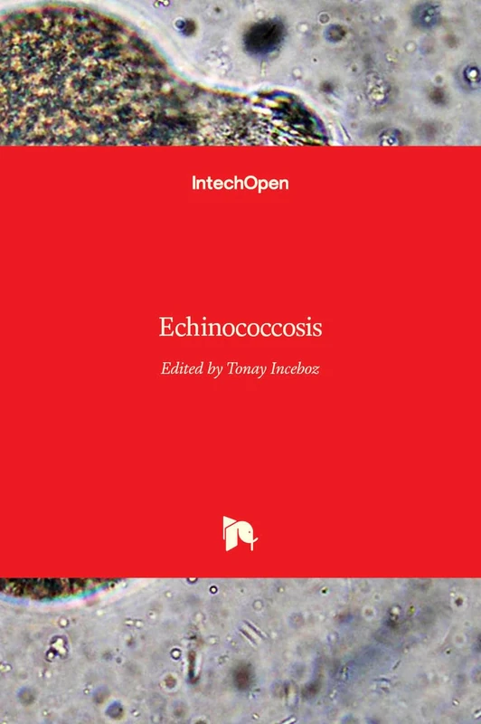 Echinococcosis - Image 1