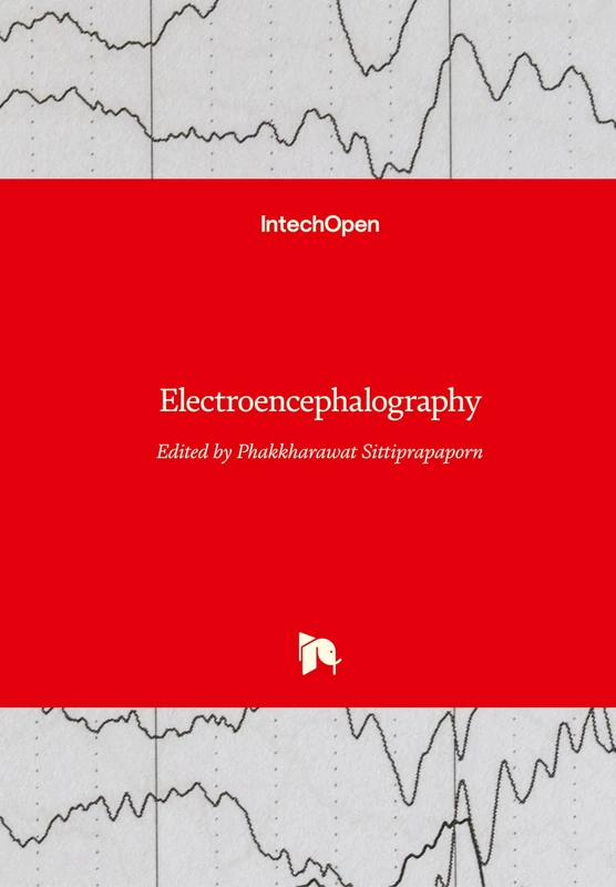 Electroencephalography - Image 1