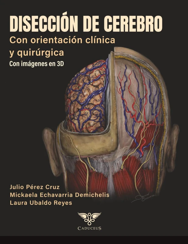 Disección de cerebro con orientación clínica y quirúrgica: Con imágenes en 3D