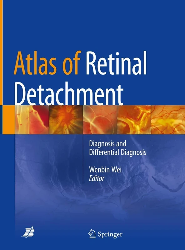 Atlas of Retinal Detachment: Diagnosis and Differential Diagnosis