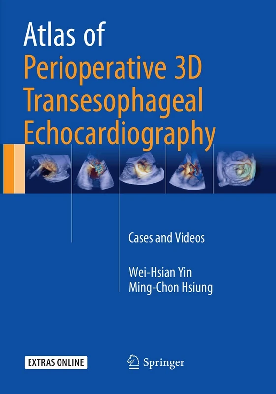 Springer Atlas of Perioperative 3D Transesophageal Echocardiography