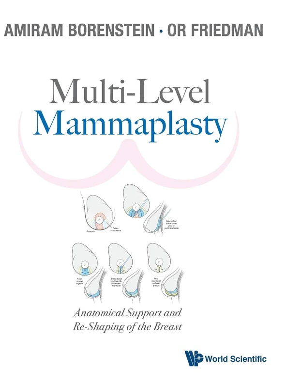Multi-Level Mammaplasty: Anatomical Support and Re-Shaping of the Breast