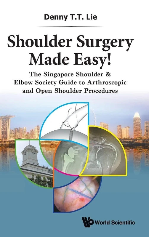 Shoulder Surgery Made Easy!: The Singapore Shoulder & Elbow Society Guide To Arthroscopic And Open Shoulder Procedures
