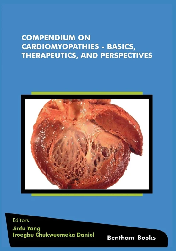 Compendium on Cardiomyopathies - Basics, Therapeutics, and Perspectives: 3 (Frontiers in Myocardia)