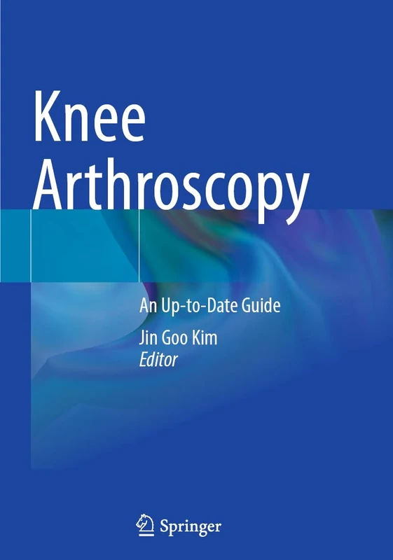 Knee Arthroscopy: An Up-to-Date Guide