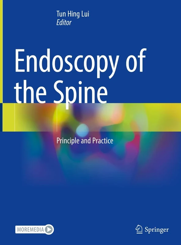 Endoscopy of the Spine: Principle and Practice