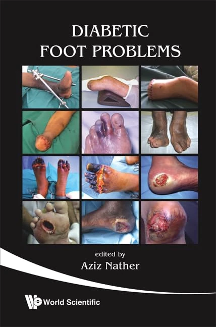 DIABETIC FOOT PROBLEMS