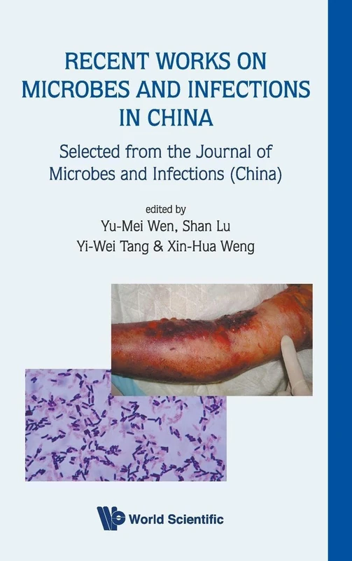 RECENT WORKS ON MICROBES AND INFECTIONS IN CHINA: SELECTED FROM THE JOURNAL OF MICROBES AND INFECTIONS (CHINA)