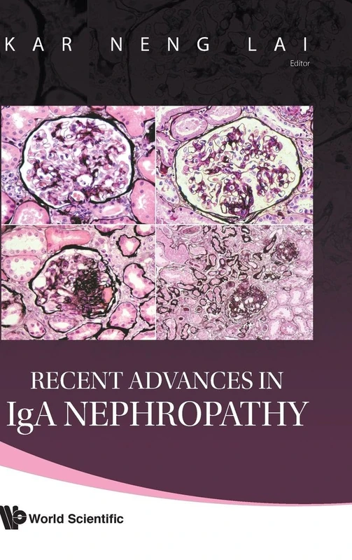 World Scientific Recent Advances in IgA Nephropathy Book