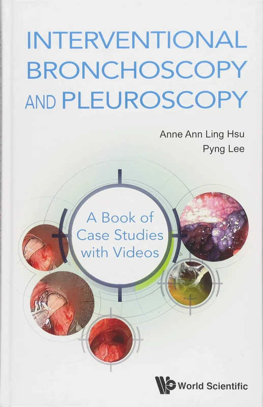 Interventional Bronchoscopy And Pleuroscopy: A Book Of Case Studies With Videos