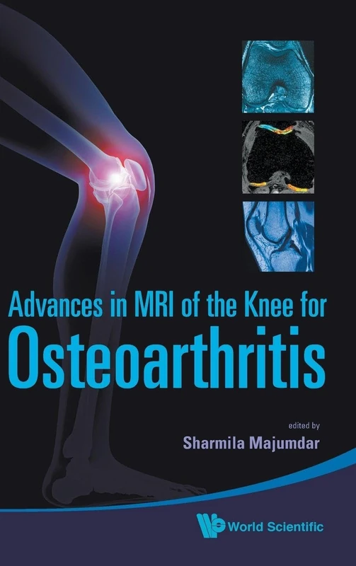 Advances In Mri Of The Knee For Osteoarthritis