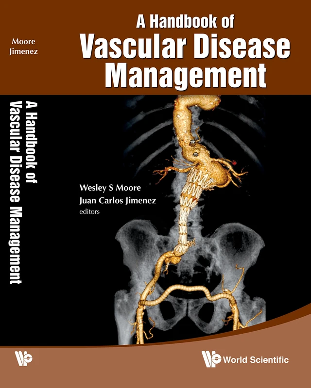 A Handbook of Vascular Disease Management