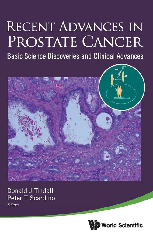 Recent Advances in Prostate Cancer: Basic Science Discoveries and Clinical Advances