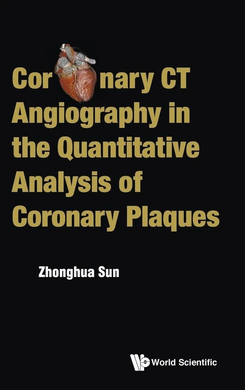 Coronary Ct Angiography In The Quantitative Analysis Of Coronary Plaques - Image 1