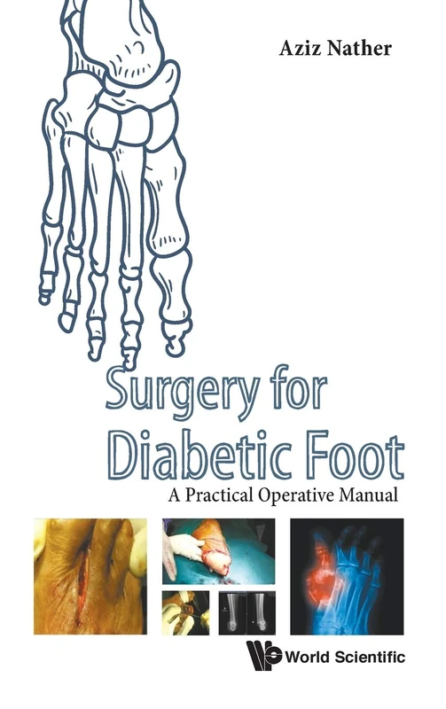 Surgery for Diabetic Foot: A Practical Operative Manual