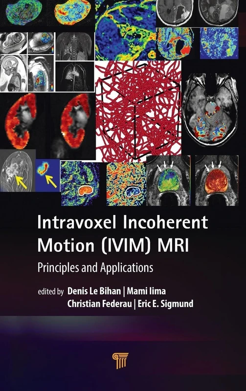 Taylor & Francis - Intravoxel Incoherent Motion (IVIM) MRI - Image 1