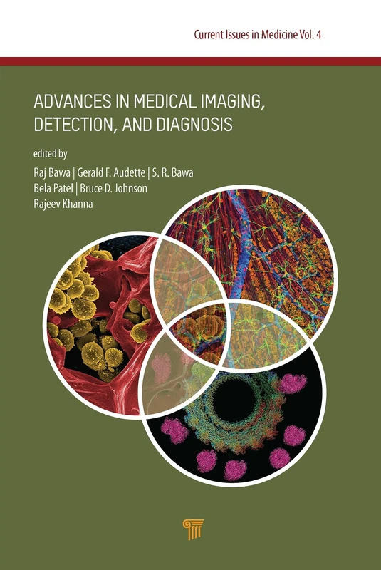 Advances in Medical Imaging, Detection, and Diagnosis: Advances in Medical Imaging, Detection, and Diagnosis (Jenny Stanford Series on Current Issues in Medicine, Volume 4)