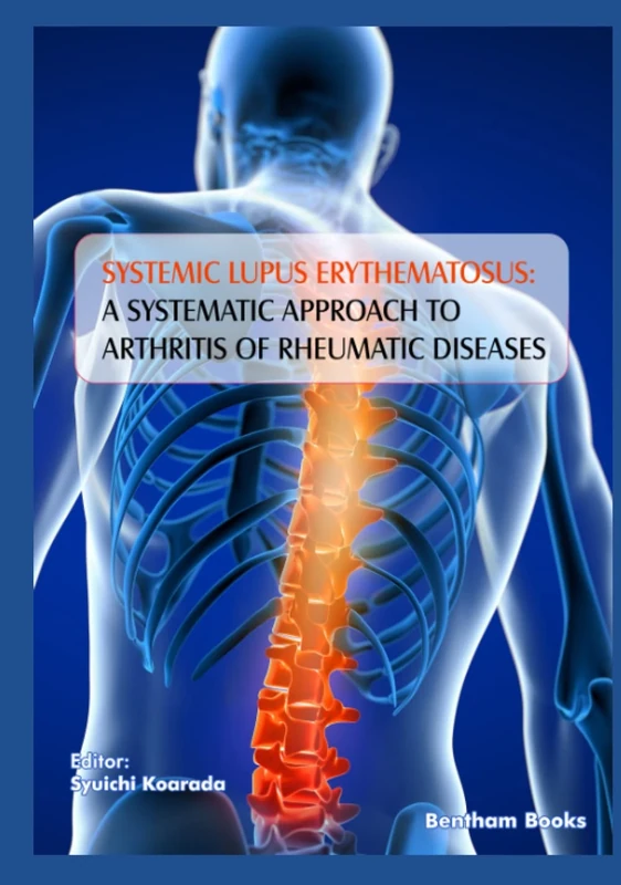Systemic Lupus Erythematosus: A Systematic Approach to Arthritis of Rheumatic Diseases