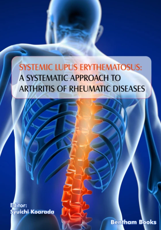 Systemic Lupus Erythematosus: A Systematic Approach to Arthritis of Rheumatic Diseases