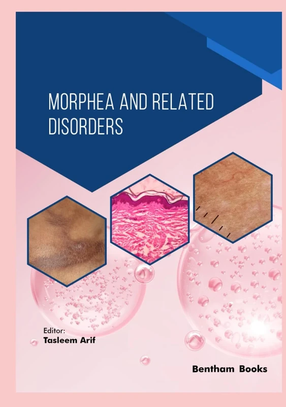 Morphea and Related Disorders