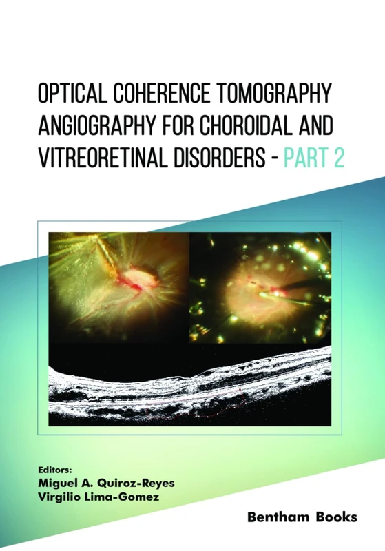 Optical Coherence Tomography Angiography for Choroidal and Vitreoretinal Disorders – Part 2