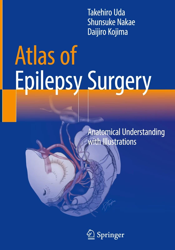 Atlas of Epilepsy Surgery: Anatomical Understanding with Illustrations