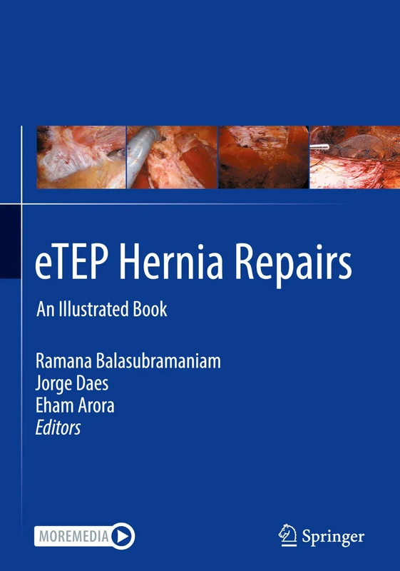 eTEP Hernia Repairs: An Illustrated Book