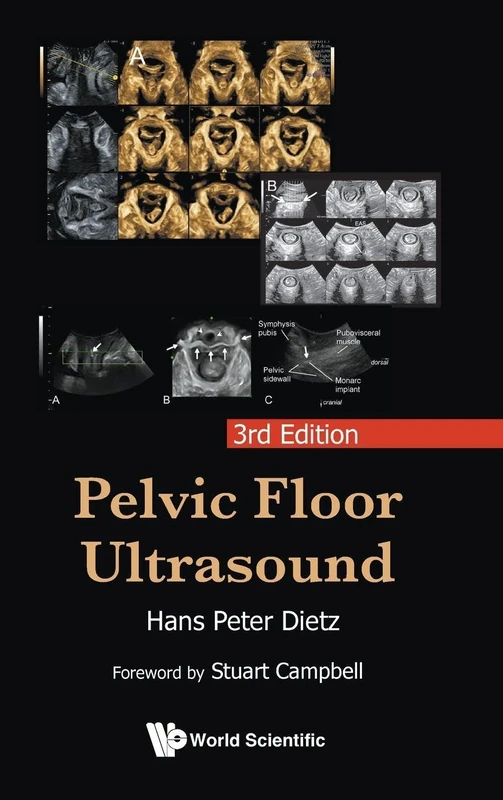 Pelvic Floor Ultrasound (3rd Edition)