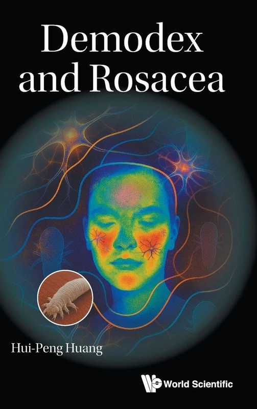 Demodex And Rosacea