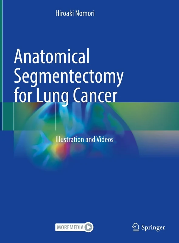 Anatomical Segmentectomy for Lung Cancer: Illustration and Videos