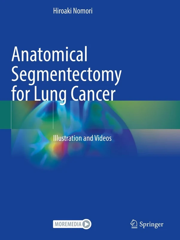 Anatomical Segmentectomy for Lung Cancer: Illustration and Videos