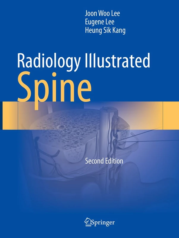 Radiology Illustrated: Spine