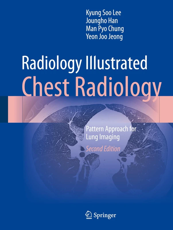Radiology Illustrated: Chest Radiology: Pattern Approach for Lung Imaging