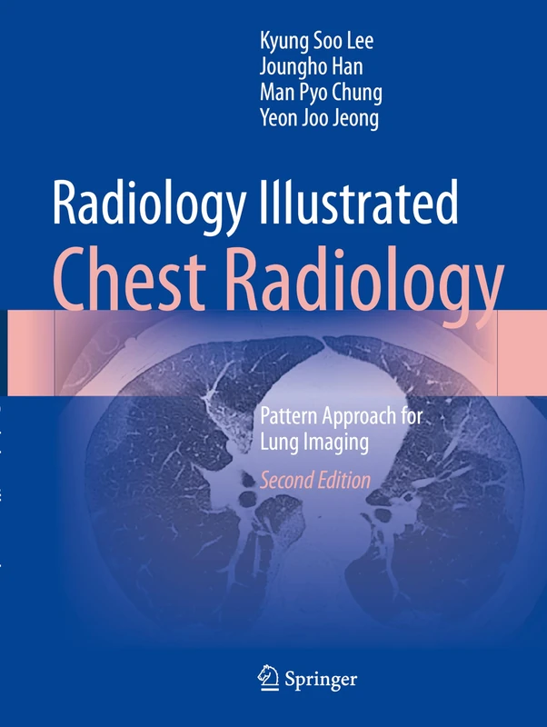 Radiology Illustrated: Chest Radiology: Pattern Approach for Lung Imaging