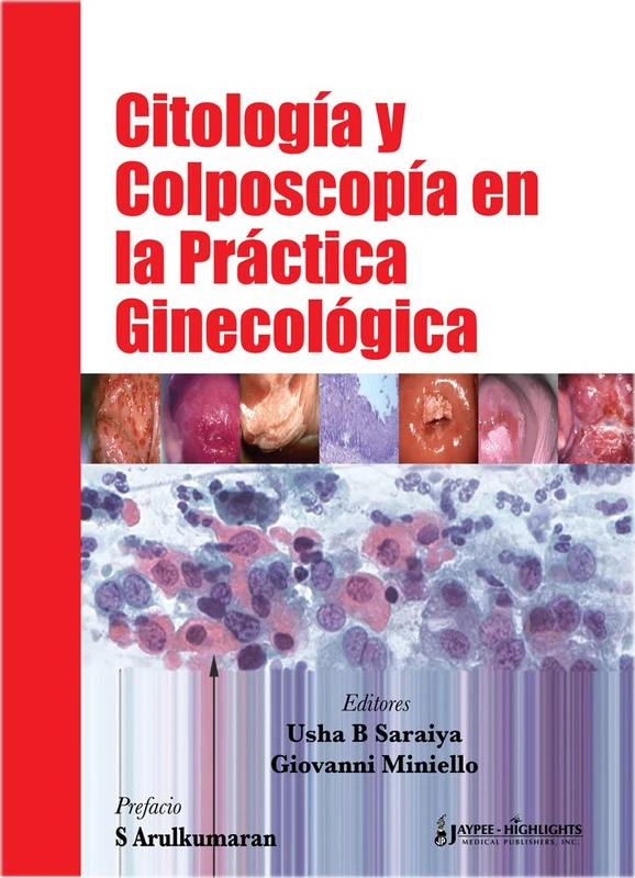 Citologia y Colposcopia En La Practica Ginecologica