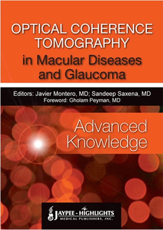 Oct in Macular Diseases and Glaucoma
