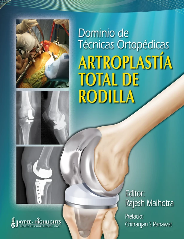 Dominio De Tecnicas Ortopedicas: Artroplastia Total De Rodilla: Artroplastía Total de Rodilla