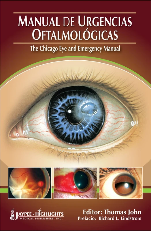 Manual De Urgencias Oftalmologicas - "The Chicago Eye and Emergency Manual"