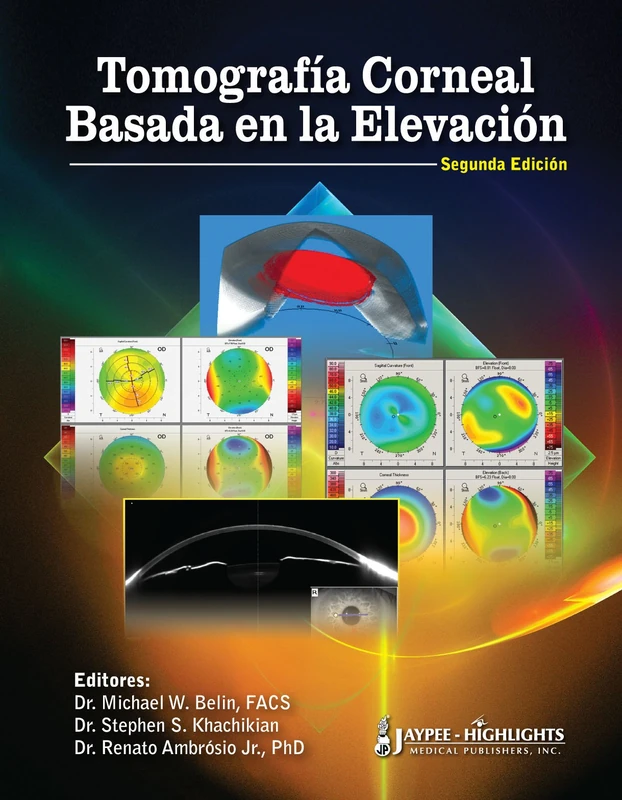Tomografia Corneal Basada En La Elevacion