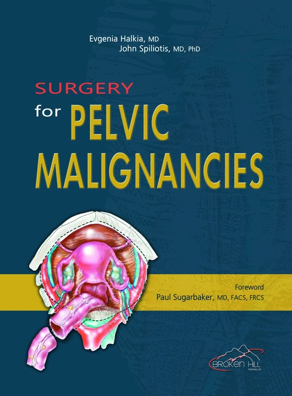 Surgery for Pelvic Malignancies