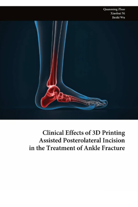 Clinical Effects of 3D Printing Assisted Posterolateral Incision in the Treatment of Ankle Fracture