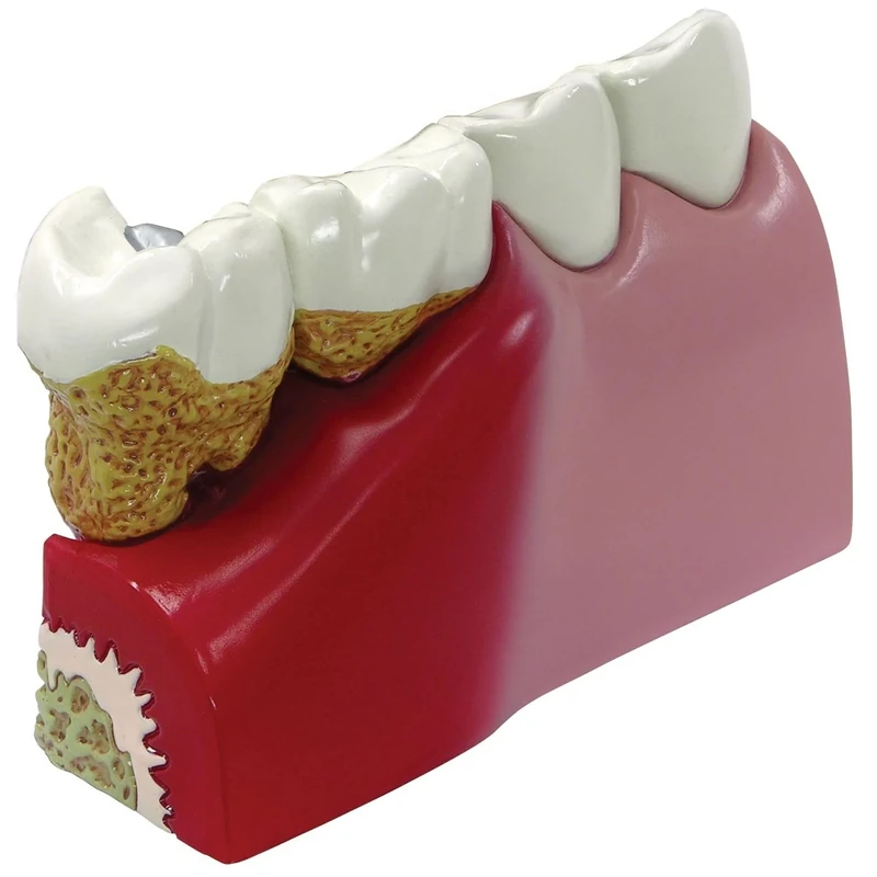 3B Scientific Teeth Model
