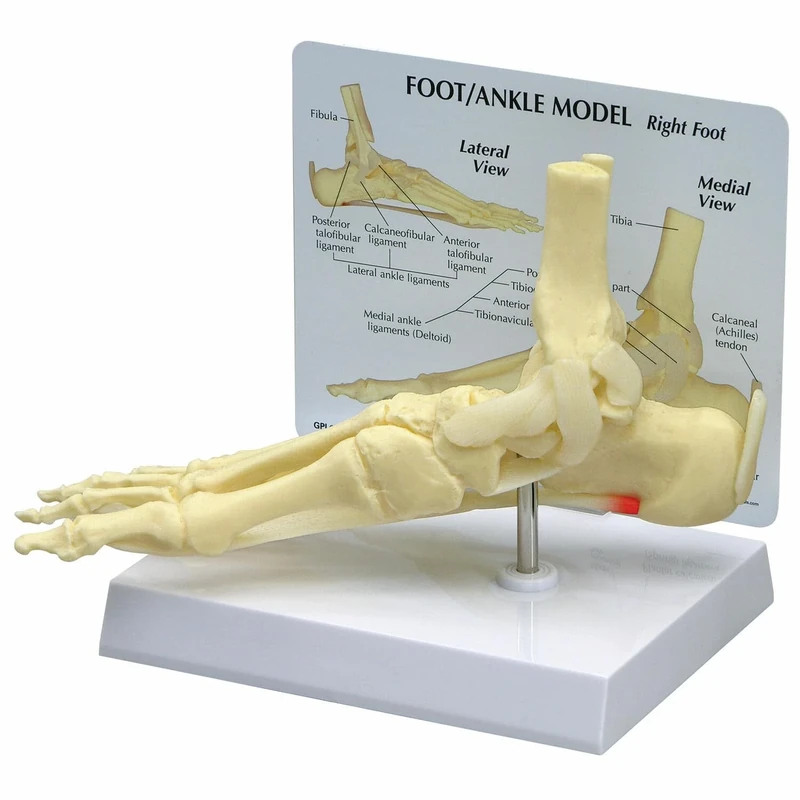 3B Scientific Foot/Ankle - Plantar Fasciitis Model