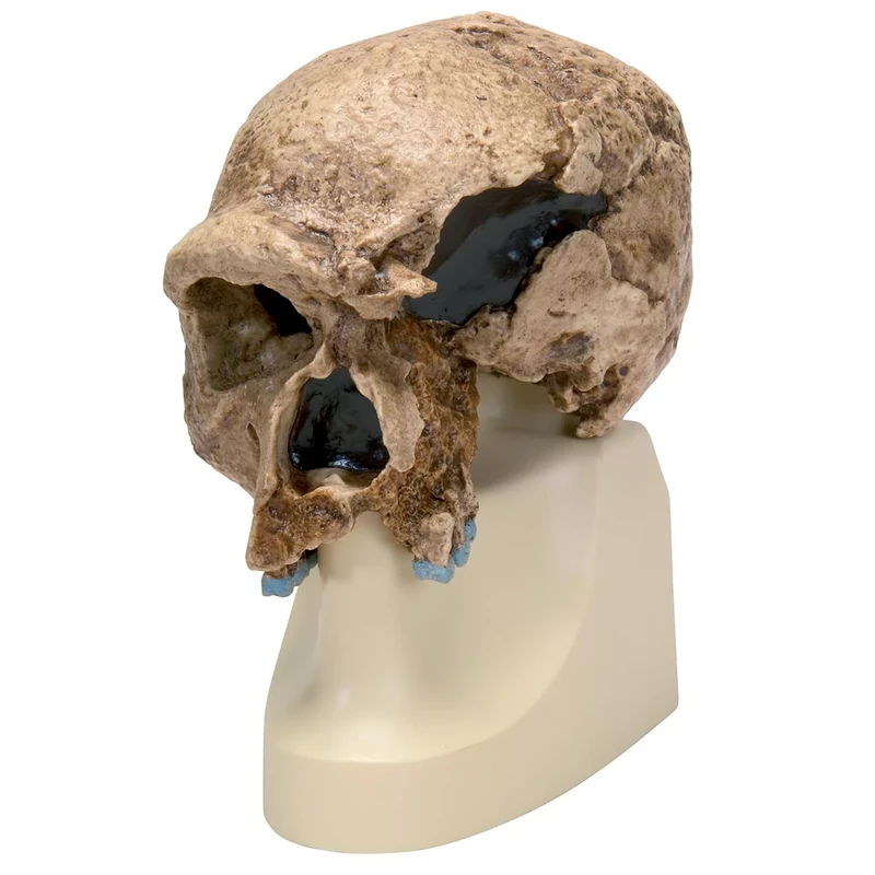 3B Scientific VP753/1 Homo Steinheimensis Skull (Berkhemer, 1936) Model, Replica