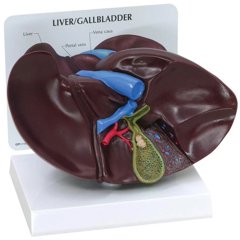 3B Scientific 1019551 Liver/Gallbladder Model with Gallstones - Image 1